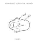 Knee Pad Constructions diagram and image