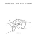 Knee Pad Constructions diagram and image