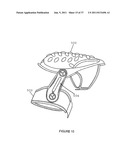 Knee Pad Constructions diagram and image