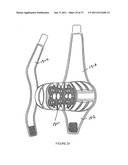 Knee Pad Constructions diagram and image