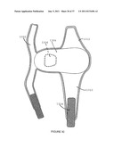 Knee Pad Constructions diagram and image