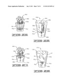 PLANT PACKAGE HAVING A DECORATIVE COVERING diagram and image