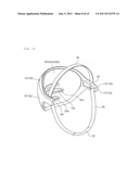 Head-Shape Remodelling Instrument diagram and image