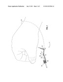 DENTAL LANYARD DEVICE diagram and image