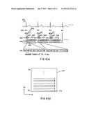 NUCLEAR MAGNETIC RESONANCE IMAGING APPARATUS diagram and image