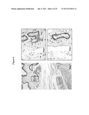 Multipotent stem cells from the extrahepatic biliary tree and methods of     isolating same diagram and image