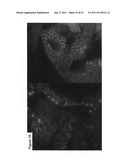 Multipotent stem cells from the extrahepatic biliary tree and methods of     isolating same diagram and image