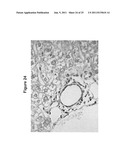 Multipotent stem cells from the extrahepatic biliary tree and methods of     isolating same diagram and image