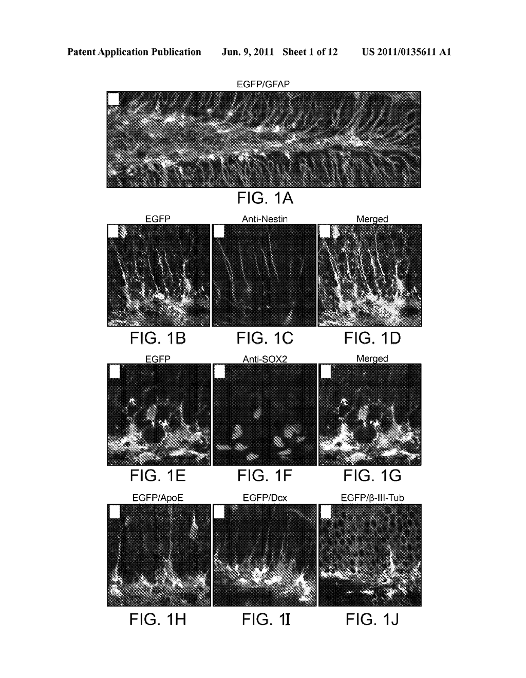 METHODS FOR TREATING APOLIPOPROTEIN E4-ASSOCIATED DISORDERS - diagram, schematic, and image 02