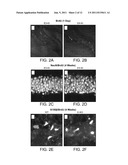 METHODS FOR TREATING APOLIPOPROTEIN E4-ASSOCIATED DISORDERS diagram and image