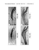 METHODS FOR TREATING APOLIPOPROTEIN E4-ASSOCIATED DISORDERS diagram and image