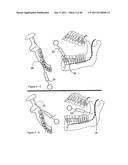 METHOD AND A DEVICE FOR PRACTICING DENTAL TREATMENTS diagram and image