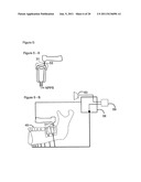 METHOD AND A DEVICE FOR PRACTICING DENTAL TREATMENTS diagram and image