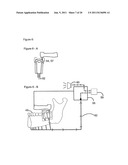 METHOD AND A DEVICE FOR PRACTICING DENTAL TREATMENTS diagram and image