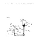 METHOD AND A DEVICE FOR PRACTICING DENTAL TREATMENTS diagram and image