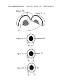 METHOD AND A DEVICE FOR PRACTICING DENTAL TREATMENTS diagram and image