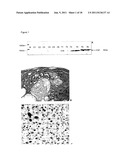 SERUM PROTEOMIC FOR FINDING DIAGNOSTIC MARKERS AND FOR MONITORING     THERAPEUTICAL INTERVENTION IN TREATMENT OF HEPATOCELLULAR CARCINOMA diagram and image