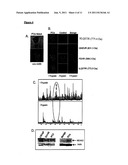 Imaging Mass Spectrometry for Improved Prostrate Cancer Diagnostics diagram and image