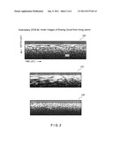 Apparatus, Systems and Methods for Measuring Flow and Pressure within a     Vessel diagram and image