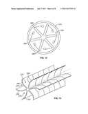 DELIVERY DEVICE FOR LOCALIZED DELIVERY OF A THERAPEUTIC AGENT diagram and image