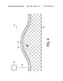 TRANSDUCER ARRANGEMENT AND METHOD FOR ACQUIRING SONO-ELASTOGRAPHICAL DATA     AND ULTRASONIC DATA OF A MATERIAL diagram and image