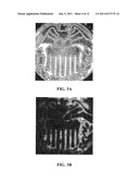 DIFFERENTIAL LASER-INDUCED PERTURBATION (DLIP) FOR BIOIMAGING AND CHEMICAL     SENSING diagram and image