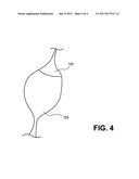 METHODS AND DEVICES FOR DELIVERING OR DELAYING LIPIDS WITHIN A DUODENUM diagram and image