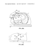 Cooperative Minimally Invasive Telesurgical System diagram and image