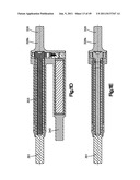 NON-FUSION SCOLIOSIS EXPANDABLE SPINAL ROD diagram and image