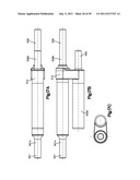 NON-FUSION SCOLIOSIS EXPANDABLE SPINAL ROD diagram and image