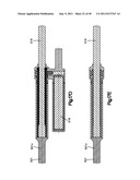 NON-FUSION SCOLIOSIS EXPANDABLE SPINAL ROD diagram and image