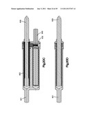 NON-FUSION SCOLIOSIS EXPANDABLE SPINAL ROD diagram and image