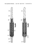 NON-FUSION SCOLIOSIS EXPANDABLE SPINAL ROD diagram and image