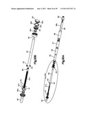 NON-FUSION SCOLIOSIS EXPANDABLE SPINAL ROD diagram and image