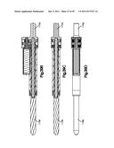 NON-FUSION SCOLIOSIS EXPANDABLE SPINAL ROD diagram and image