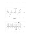 SELECTING THERAPY CYCLE PARAMETERS BASED ON MONITORED BRAIN SIGNAL diagram and image