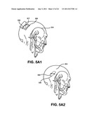 Treatment of neurological disorders via electrical stimulation, and     methods related thereto diagram and image