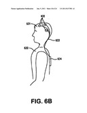 Treatment of neurological disorders via electrical stimulation, and     methods related thereto diagram and image