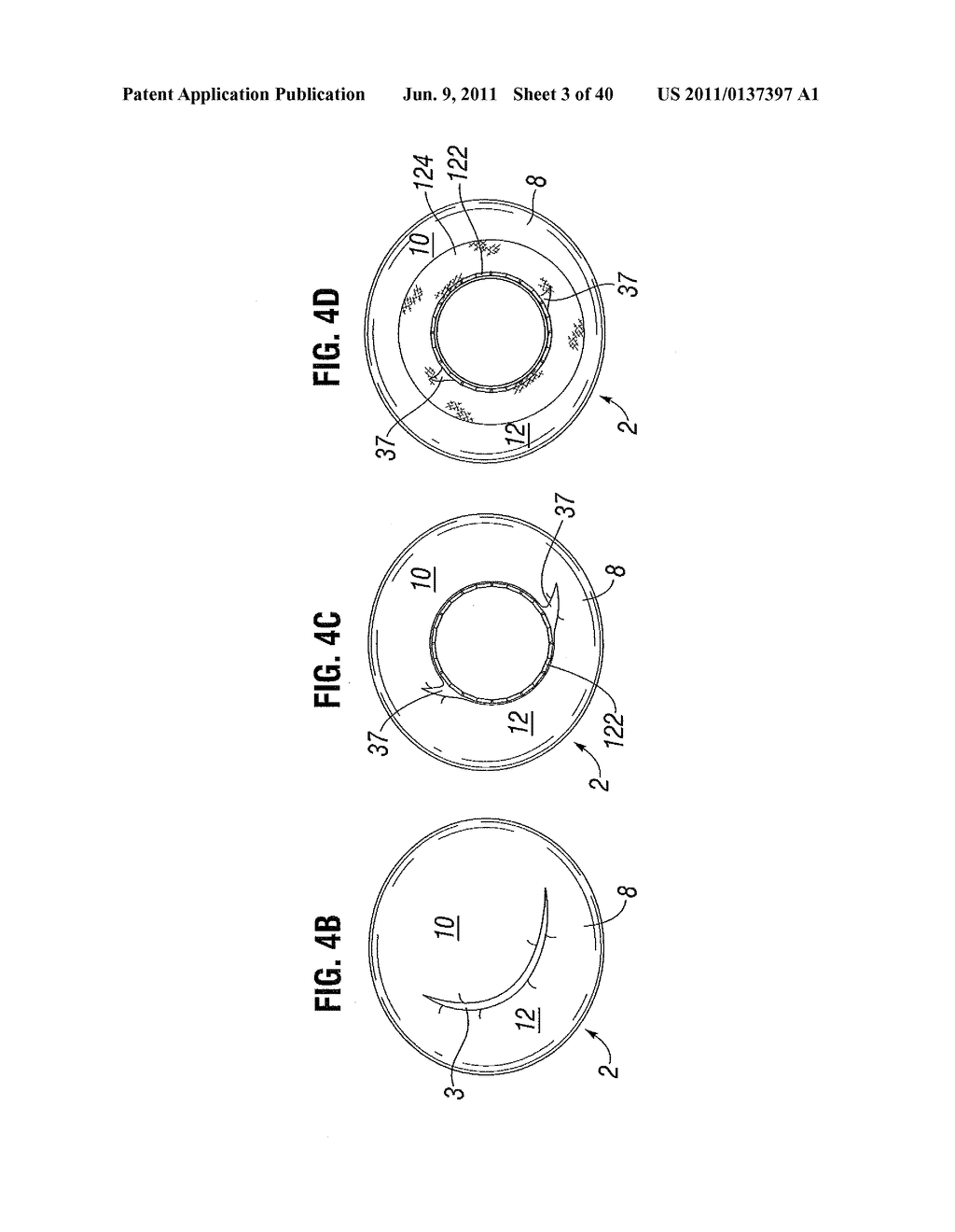 PROSTHETIC VALVE FOR REPLACING MITRAL VALVE - diagram, schematic, and image 04