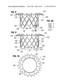 PROSTHETIC VALVE FOR REPLACING MITRAL VALVE diagram and image