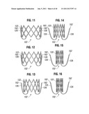 PROSTHETIC VALVE FOR REPLACING MITRAL VALVE diagram and image