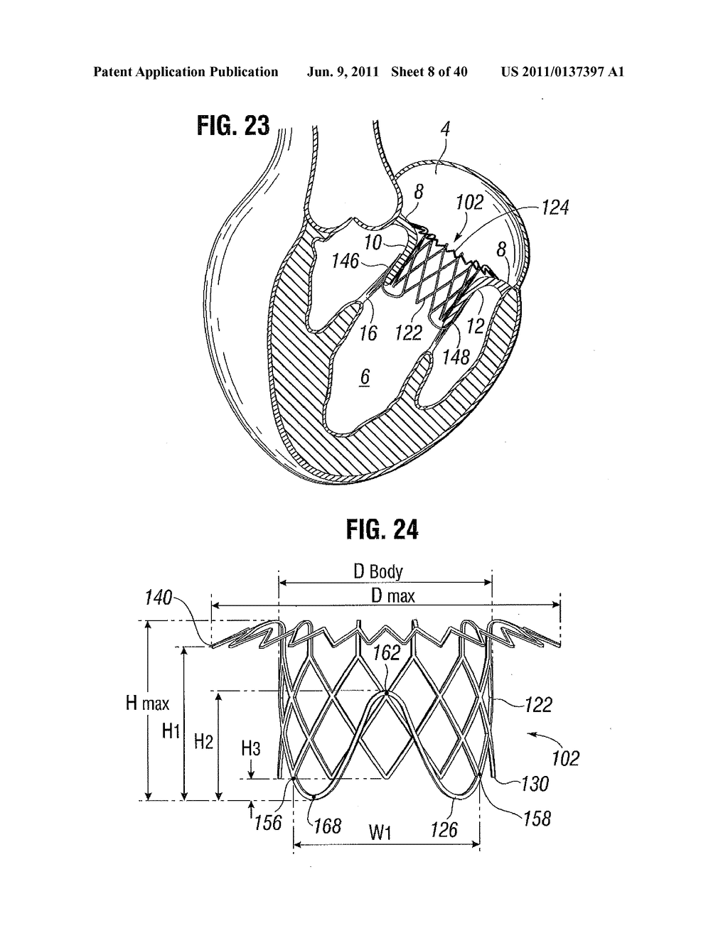 PROSTHETIC VALVE FOR REPLACING MITRAL VALVE - diagram, schematic, and image 09