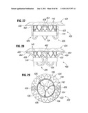 PROSTHETIC VALVE FOR REPLACING MITRAL VALVE diagram and image