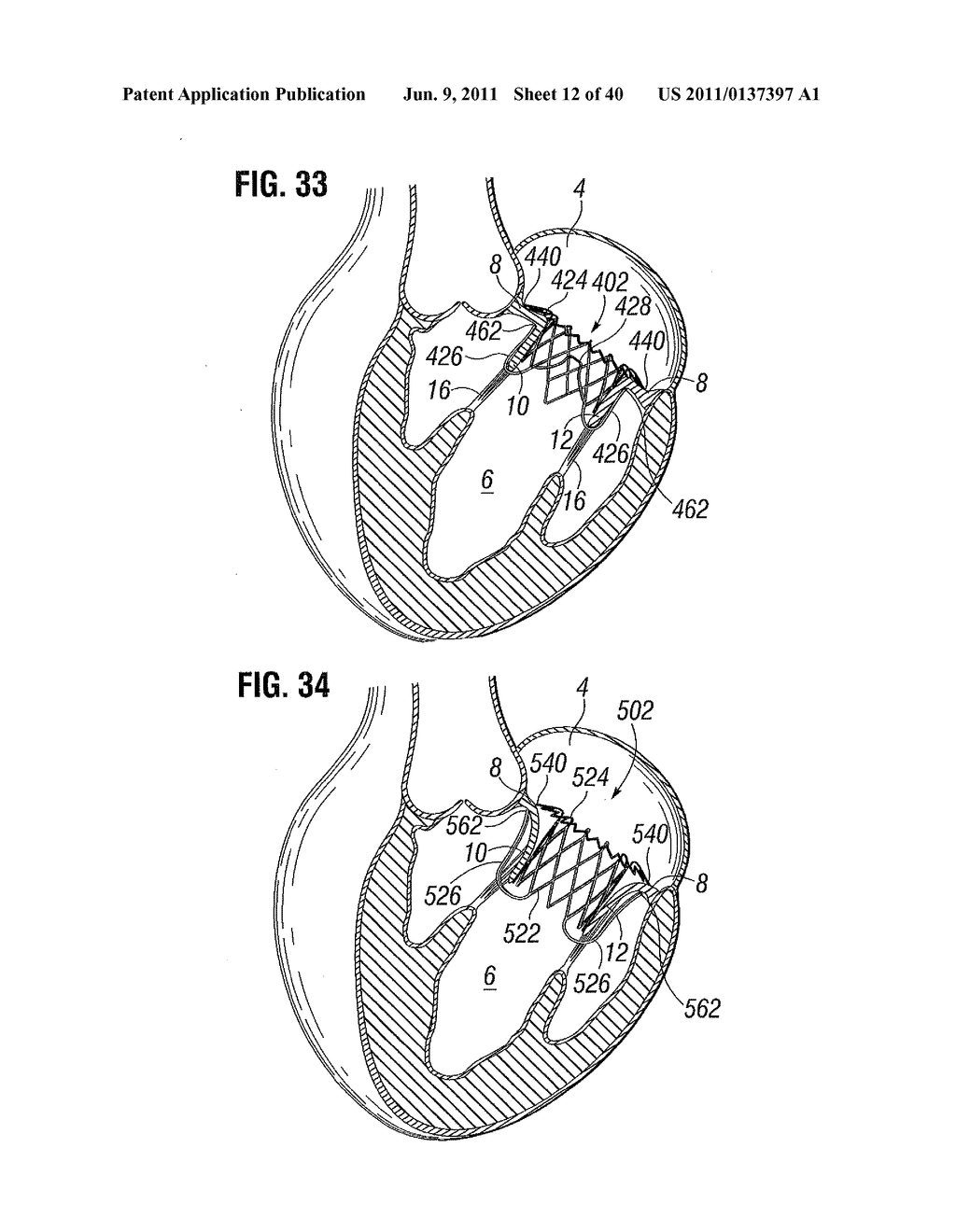 PROSTHETIC VALVE FOR REPLACING MITRAL VALVE - diagram, schematic, and image 13
