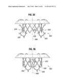 PROSTHETIC VALVE FOR REPLACING MITRAL VALVE diagram and image