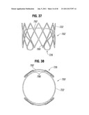 PROSTHETIC VALVE FOR REPLACING MITRAL VALVE diagram and image