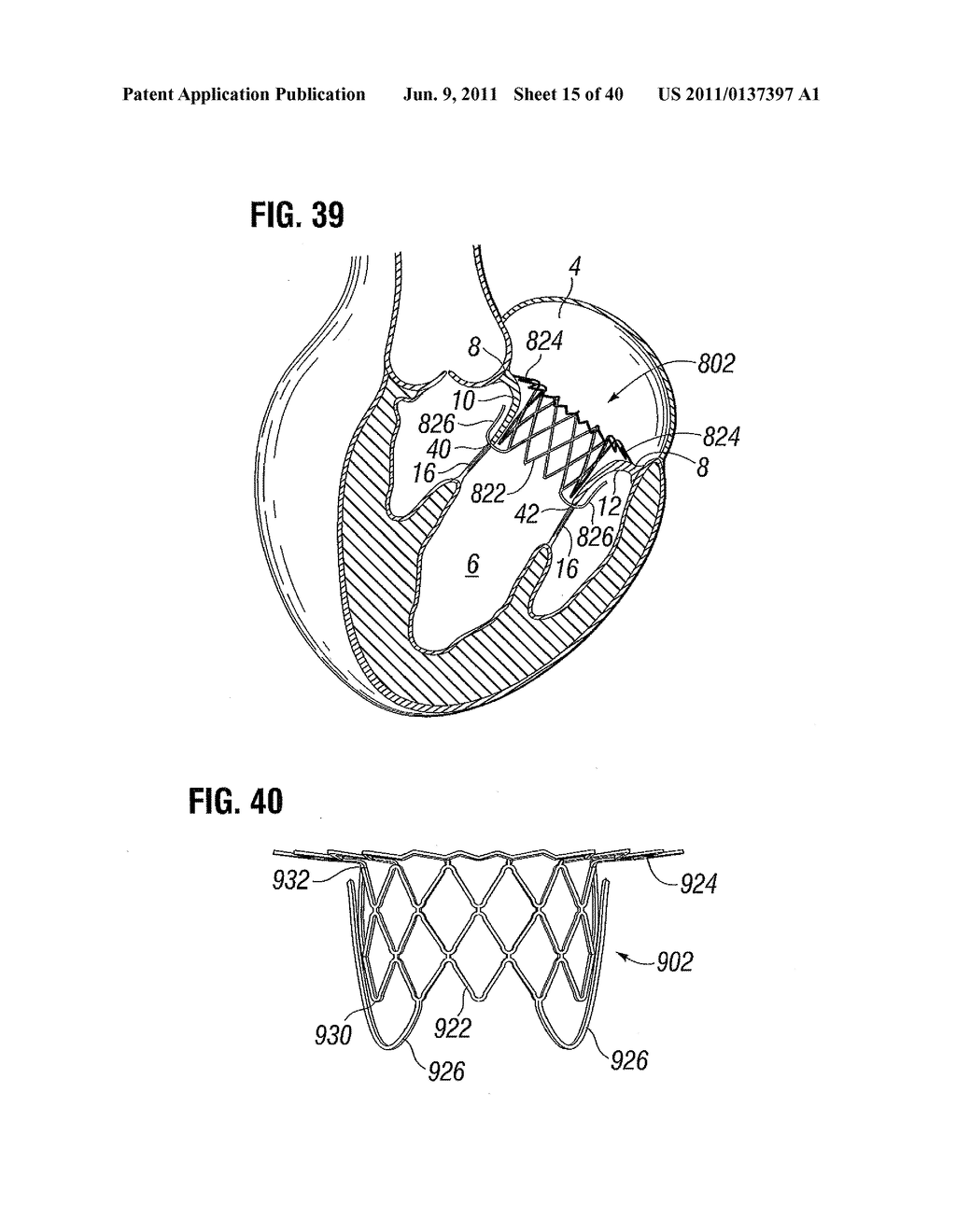 PROSTHETIC VALVE FOR REPLACING MITRAL VALVE - diagram, schematic, and image 16
