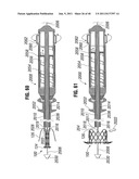 PROSTHETIC VALVE FOR REPLACING MITRAL VALVE diagram and image