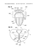 PROSTHETIC VALVE FOR REPLACING MITRAL VALVE diagram and image