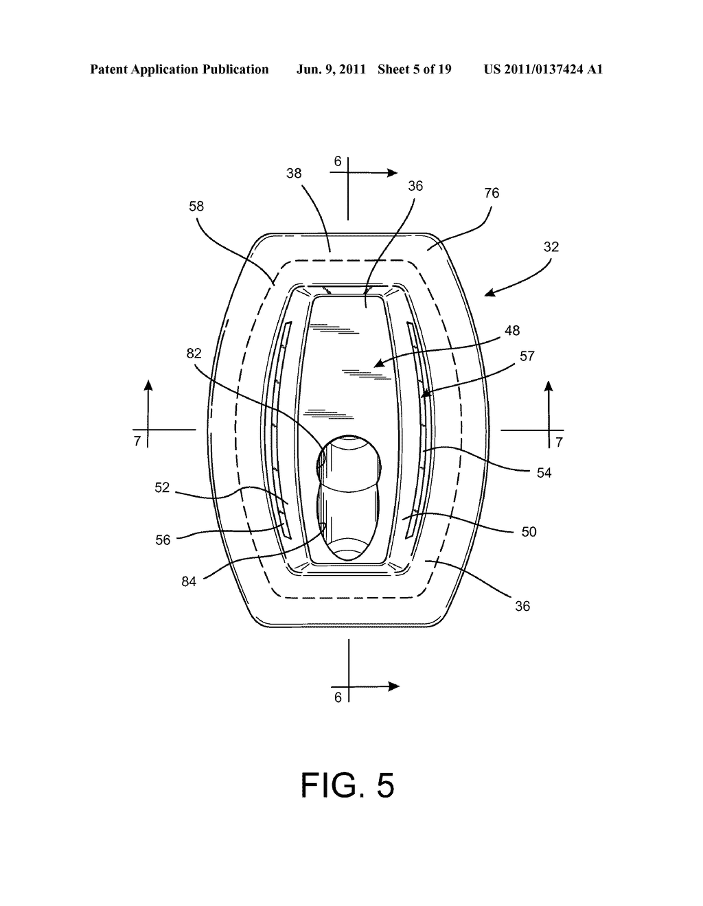 Shoulder Prosthesis Assembly having Glenoid Rim Replacement Structure - diagram, schematic, and image 06